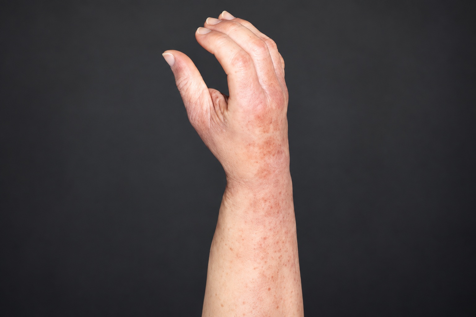 ARTech arm and hand covering
