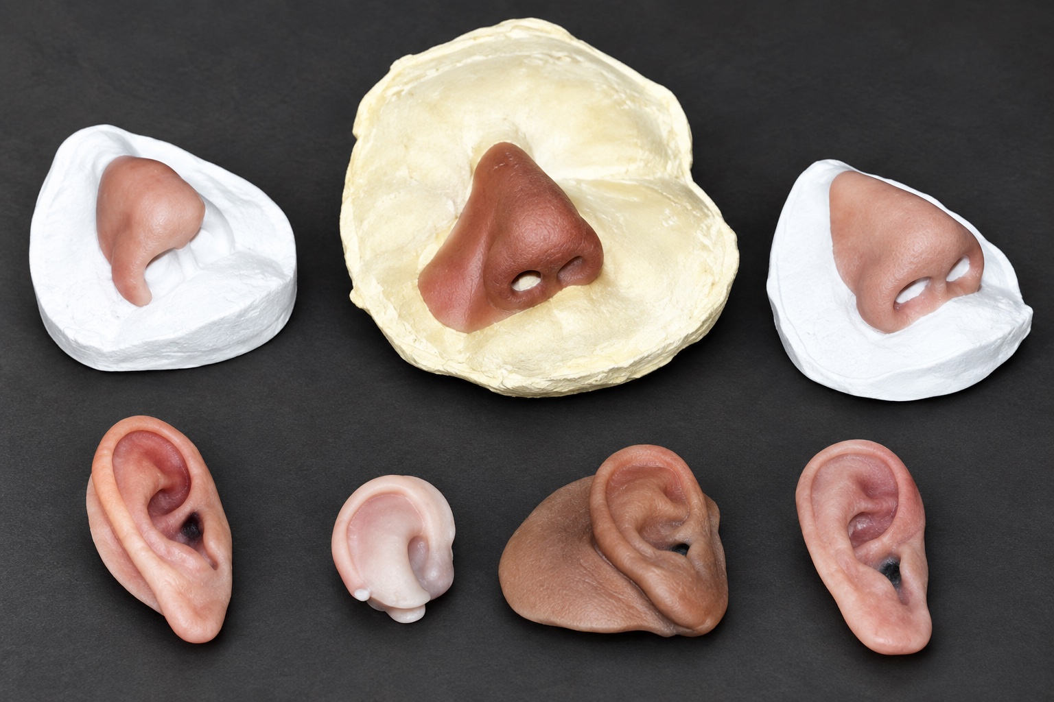 ARTech facial prosthesis examples