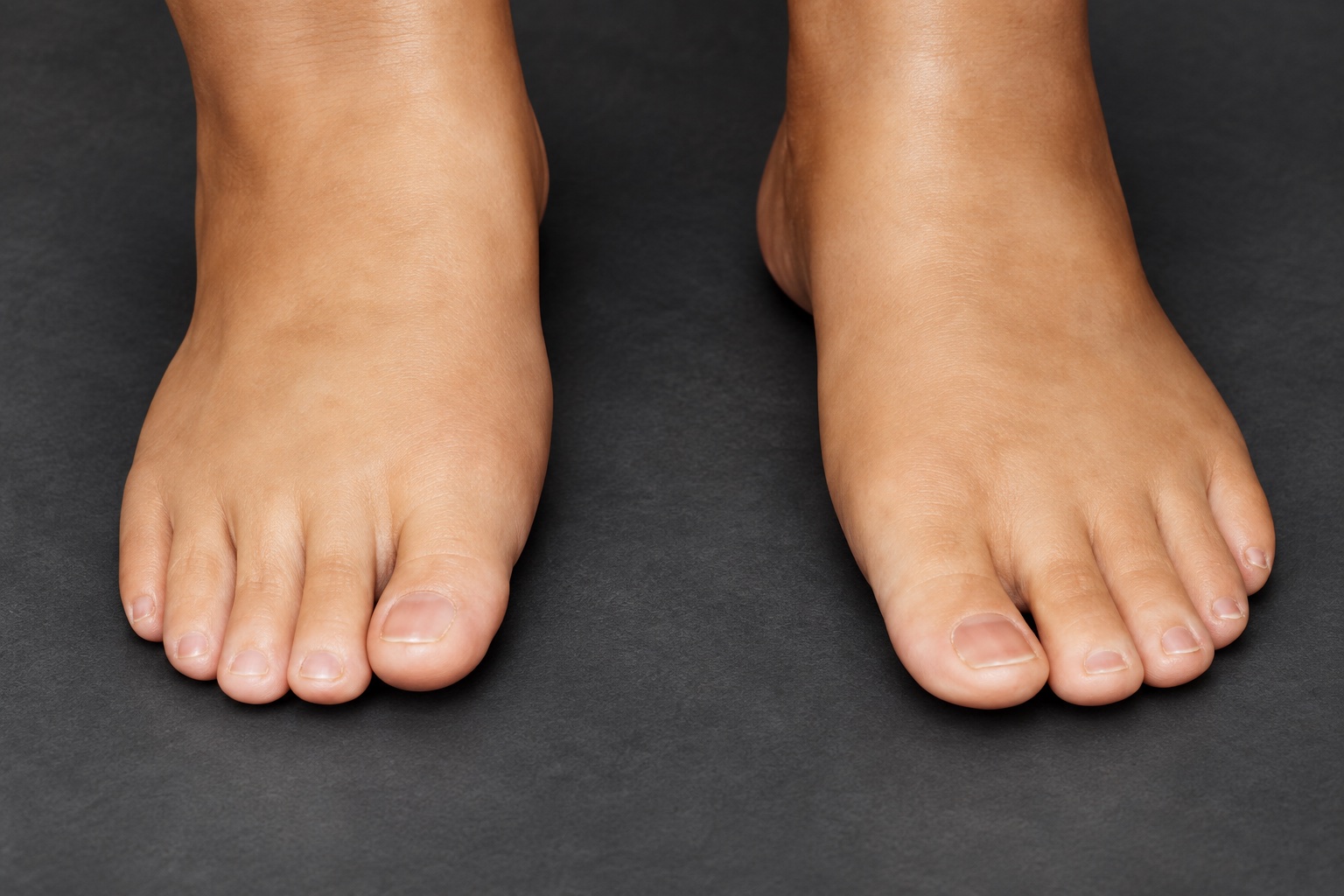 ARTech foot restoration