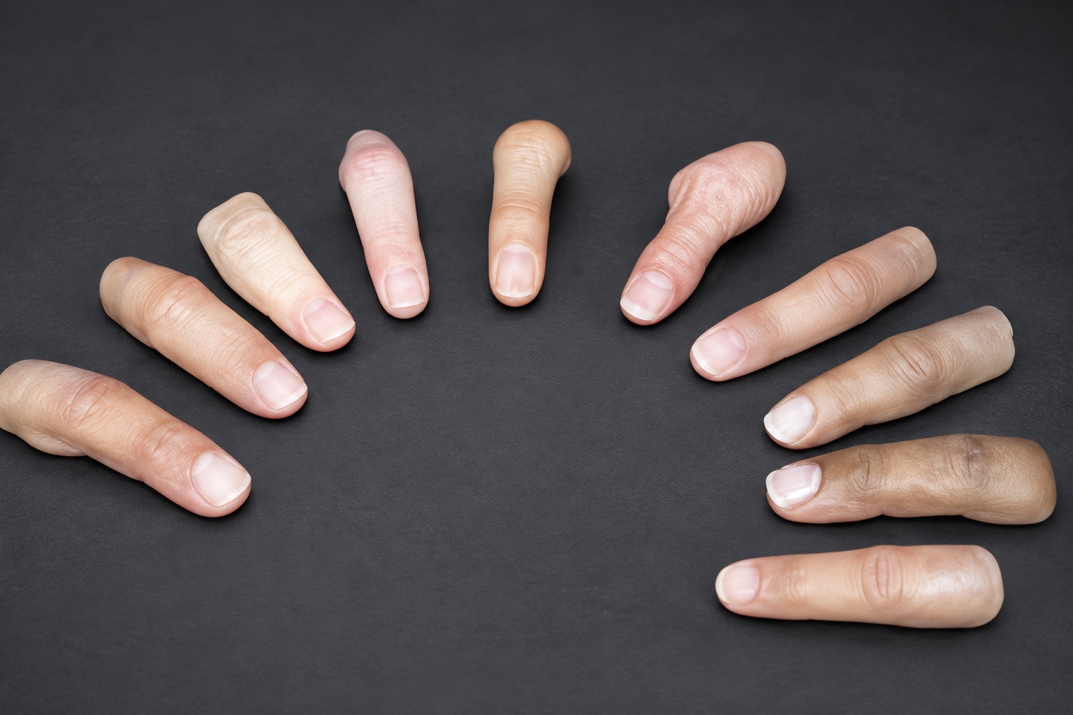 ARTech silicone finger restorations